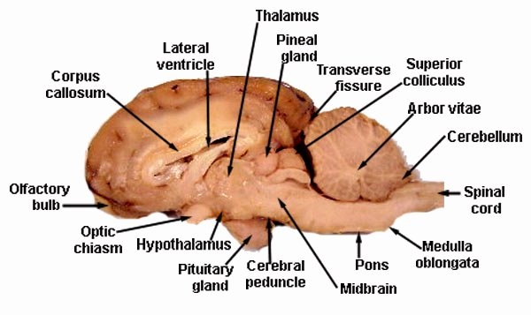 50 Sheep Brain Dissection Worksheet