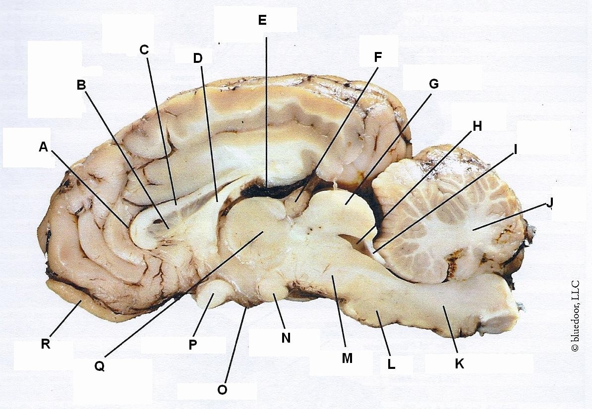50 Sheep Brain Dissection Worksheet
